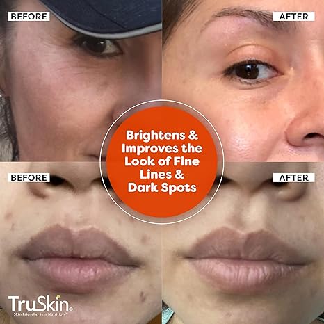 TruSkin Vitamin C Serum